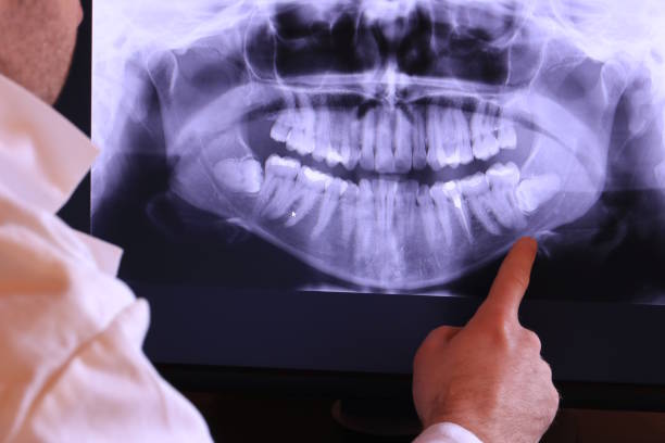 Best Dentist for Tooth Abscess  in Inman, KS