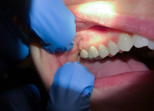 Best Cracked Tooth Emergency Dentist  in Inman, KS