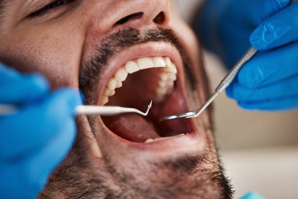 Best Emergency Tooth Extraction  in Inman, KS